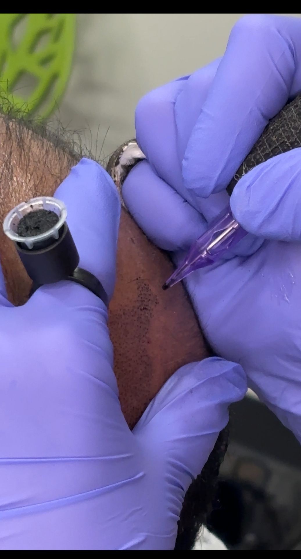 Close-up of a tattoo artist wearing purple gloves, working on a tattoo on someone's scalp.